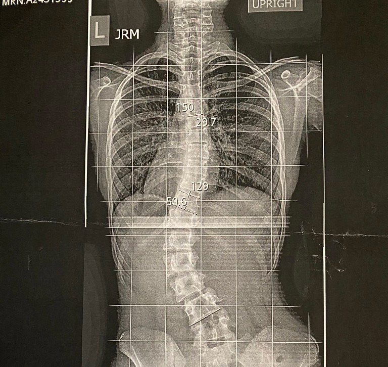 Madison’s X-ray 